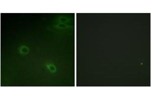Immunofluorescence analysis of HeLa cells, using CXCR4 (Phospho-Ser339) Antibody.