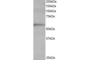 Image no. 2 for anti-T-Complex 1 (TCP1) (C-Term) antibody (ABIN185185)