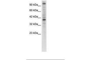 Image no. 1 for anti-Zinc Finger Protein 624 (ZNF624) (AA 499-548) antibody (ABIN6735933)
