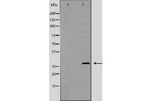 Image no. 1 for anti-SET Domain Containing 2 (SETD2) (Internal Region) antibody (ABIN6265018)