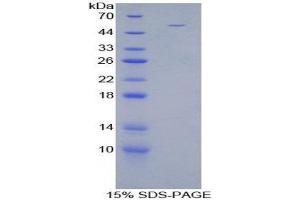 Image no. 1 for Stanniocalcin 1 (STC1) (AA 28-247) protein (His tag,GST tag) (ABIN1880005)