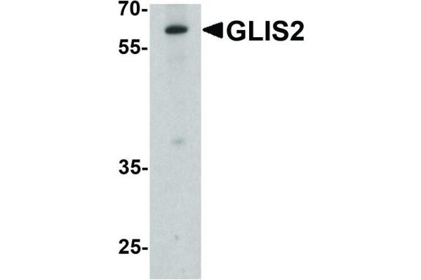 anti-GLIS Family Zinc Finger 2 (GLIS2) (Internal Region) antibody