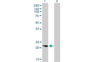 Image no. 3 for anti-Calcyphosine (CAPS) (AA 1-109) antibody (ABIN560163)