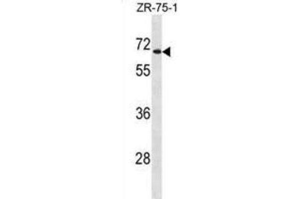 anti-UDP Glucuronosyltransferase 2 Family, Polypeptide B28 (UGT2B28) antibody