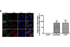Spermidine affected the accumulation of PINK1 and translocation of Parkin.