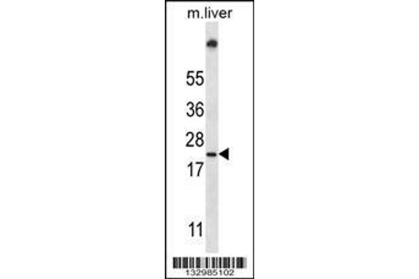 anti-Ubiquitin-Conjugating Enzyme E2W (UBE2W) (AA 105-133), (C-Term) antibody