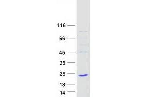Image no. 1 for TAF12 RNA Polymerase II, TATA Box Binding Protein (TBP)-Associated Factor, 20kDa (TAF12) (Transcript Variant 2) protein (Myc-DYKDDDDK Tag) (ABIN2733193)