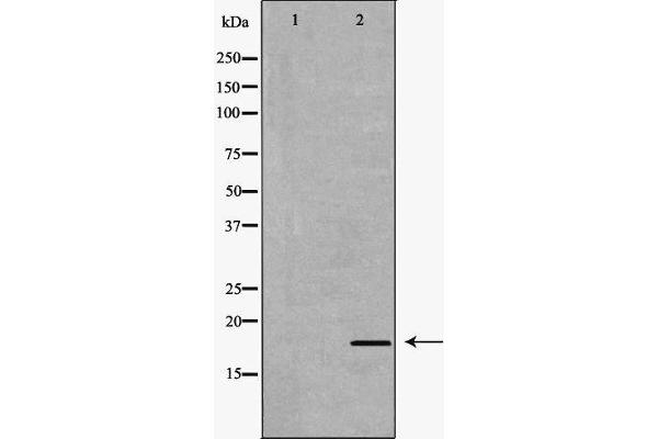 Interleukin 17a antibody  (Internal Region)