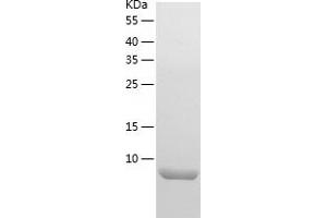 beta Defensin 1 Protein (AA 22-68) (His tag)