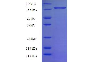 NLE1 Protein (AA 2-485) (His-SUMO Tag)