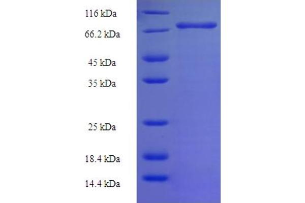 NLE1 Protein (AA 2-485) (His-SUMO Tag)