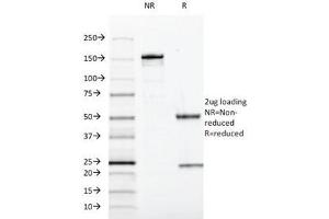 Image no. 3 for anti-SRY (Sex Determining Region Y)-Box 10 (SOX10) (AA 115-269) antibody (ABIN5646947)