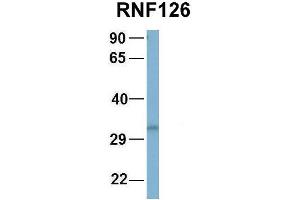 Image no. 2 for anti-Ring Finger Protein 126 (RNF126) (N-Term) antibody (ABIN2774749)