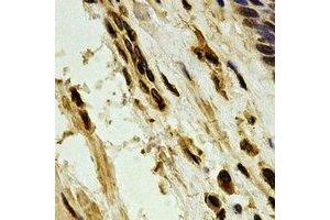 Image no. 1 for anti-Poly A Specific Ribonuclease (PARN) antibody (ABIN2966877)