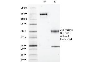Image no. 1 for anti-S100 Calcium Binding Protein A1 (S100A1) antibody (ABIN6940539)