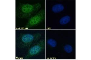 Image no. 1 for anti-Single-Strand-Selective Monofunctional Uracil-DNA Glycosylase 1 (SMUG1) (N-Term) antibody (ABIN185204)