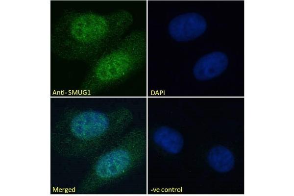 anti-Single-Strand-Selective Monofunctional Uracil-DNA Glycosylase 1 (SMUG1) (N-Term) antibody