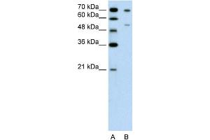 Image no. 1 for anti-Forkhead Box B2 (FOXB2) (N-Term) antibody (ABIN2775589)