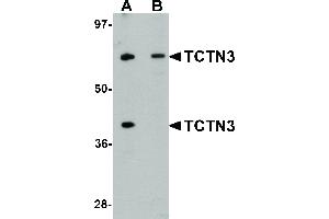 Image no. 1 for anti-Tectonic Family Member 3 (TCTN3) (C-Term) antibody (ABIN6657173)