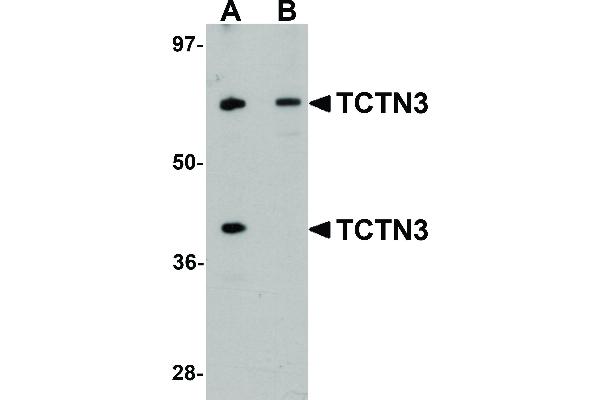 anti-Tectonic Family Member 3 (TCTN3) (C-Term) antibody