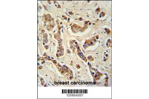 Immunohistochemistry (IHC) image for anti-Family with Sequence Similarity 20, Member A (FAM20A) antibody (ABIN2158771)