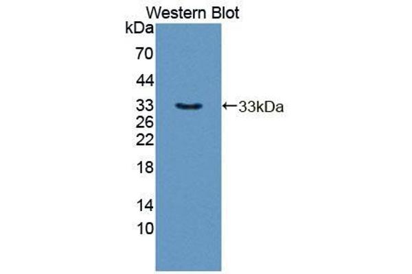 anti-Regulator of G-Protein Signaling 3 (RGS3) (AA 1-261) antibody