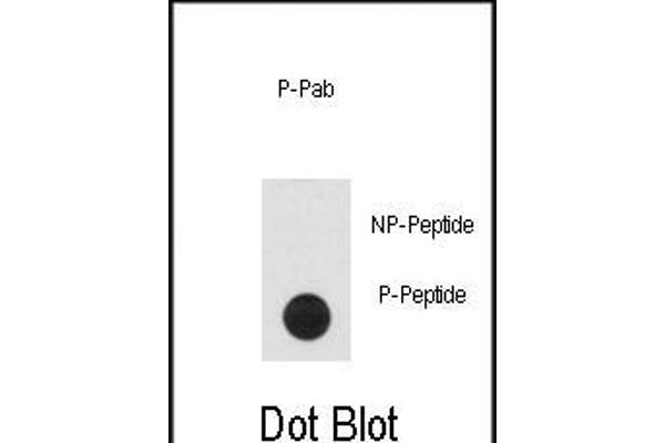 CLASP1 antibody  (pThr656)