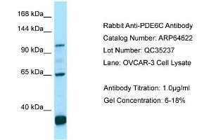 Image no. 1 for anti-phosphodiesterase 6C, CGMP-Specific, Cone, alpha Prime (PDE6C) (C-Term) antibody (ABIN2774403)