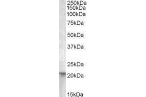 Image no. 5 for anti-GTPase NRas (NRAS) (Internal Region) antibody (ABIN302138)