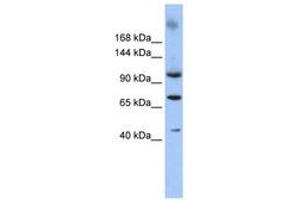 Image no. 1 for anti-Terminal Uridylyl Transferase 1, U6 SnRNA-Specific (TUT1) (AA 253-302) antibody (ABIN6740335)