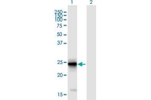 Image no. 1 for anti-Fin Bud Initiation Factor Homolog (FIBIN) (AA 1-211) antibody (ABIN2752237)