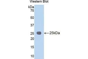 Image no. 2 for Interleukin 1 Receptor Accessory Protein (IL1RAP) ELISA Kit (ABIN6730975)