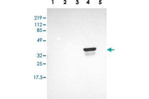 Image no. 3 for anti-Ornithine Carbamoyltransferase (OTC) antibody (ABIN5585070)
