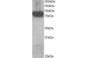 Image no. 1 for anti-Junction Plakoglobin (JUP) (C-Term) antibody (ABIN184775)