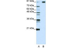 Image no. 3 for anti-Splicing Factor 3b, Subunit 1, 155kDa (SF3B1) (Middle Region) antibody (ABIN2778699)