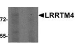 Image no. 1 for anti-Leucine Rich Repeat Transmembrane Neuronal 4 (LRRTM4) (Center) antibody (ABIN783389)