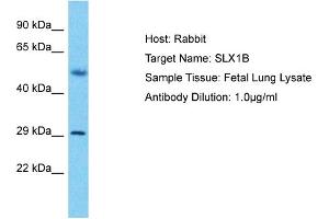 Image no. 1 for anti-SLX1 Structure-Specific Endonuclease Subunit Homolog B (SLX1B) (C-Term) antibody (ABIN2791913)