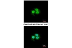 Image no. 3 for anti-Musashi Homolog 1 (Drosophila) (MSI1) (Center) antibody (ABIN2855085)
