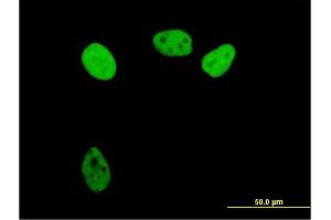 Image no. 2 for anti-Replication Protein A1, 70kDa (RPA1) (AA 1-616) antibody (ABIN948414)