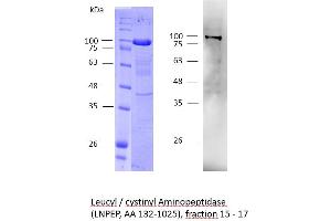 Image no. 2 for Leucyl/cystinyl Aminopeptidase (LNPEP) (AA 132-1025) protein (His tag) (ABIN3093476)