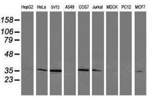 Image no. 2 for anti-Cyclin-Dependent Kinase 2 (CDK2) antibody (ABIN1497399)