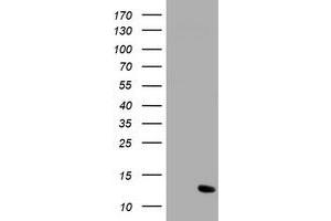Image no. 1 for anti-Chromosome 17 Open Reading Frame 37 (C17orf37) antibody (ABIN1501779)