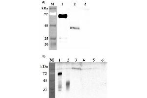 Image no. 1 for anti-delta-Like 1 Homolog (Drosophila) (DLK1) (Extracellular Domain) antibody (ABIN1169188)