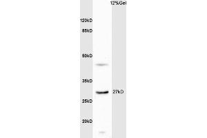 Image no. 2 for anti-Dehydrogenase/reductase (SDR Family) Member 2 (DHRS2) (AA 21-120) antibody (ABIN1387246)