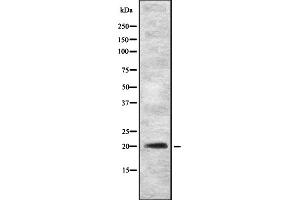 Image no. 1 for anti-Gastrokine 2 (GKN2) (Internal Region) antibody (ABIN6258934)