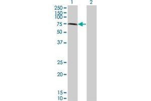 anti-Checkpoint with Forkhead and Ring Finger Domains (CHFR) (AA 136-194) antibody