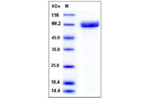 Image no. 1 for Acetylcholinesterase (AChE) (AA 1-614) (Active) protein (His tag) (ABIN2007953)