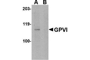 Image no. 1 for anti-Glycoprotein VI (Platelet) (GP6) (Middle Region) antibody (ABIN1030943)