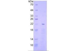 Image no. 2 for Early Growth Response 1 (EGR1) ELISA Kit (ABIN6730895)