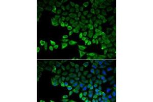 Immunofluorescence analysis of HeLa cells using RIG-I / DDX58 Polyclonal Antibody